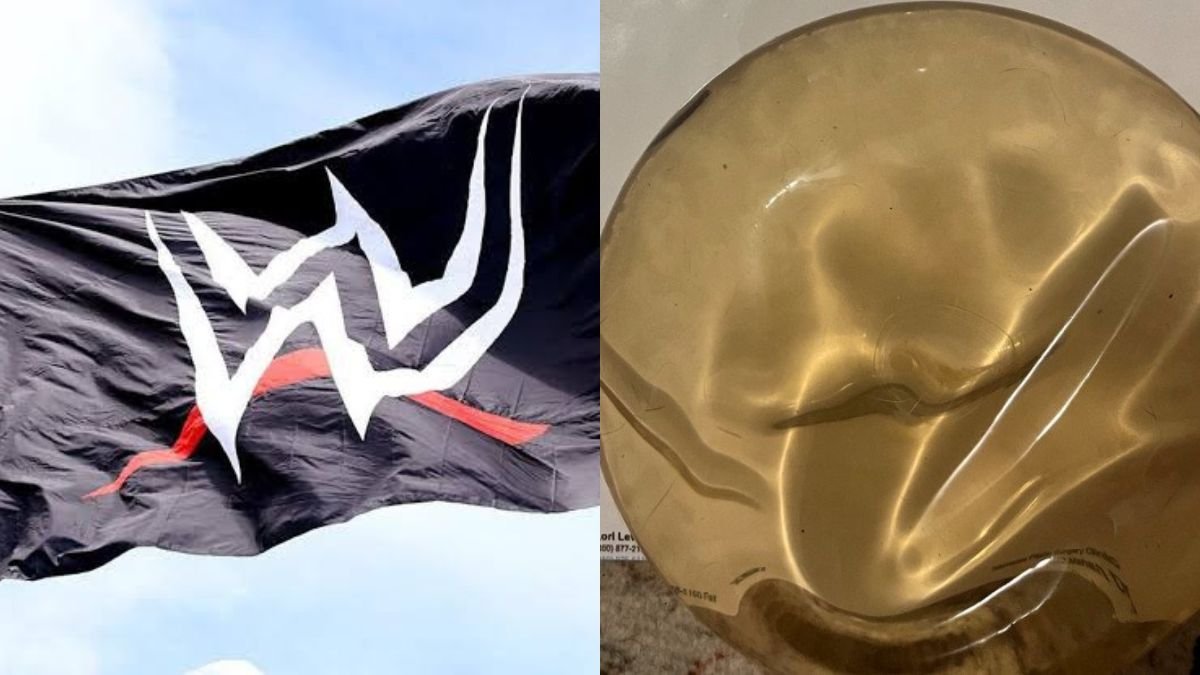 Former WWE Star Is Selling Her Breast Implant – It’s Gross And Stupid!!